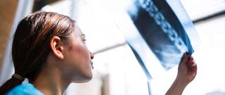 medical professional examining an x-ray they hold up to a natural light source using their left hand